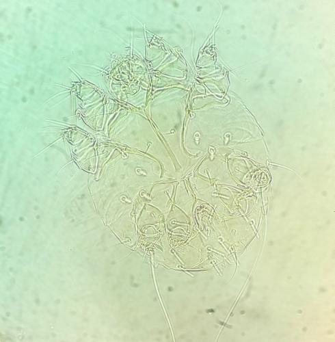 Réf. 353 958 : Sarcoptes scabiei